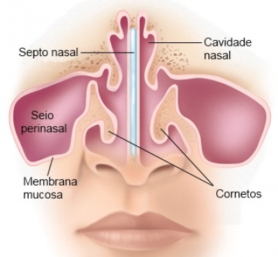 Quando a cirurgia está indicada para a resolução da obstrução nasal?